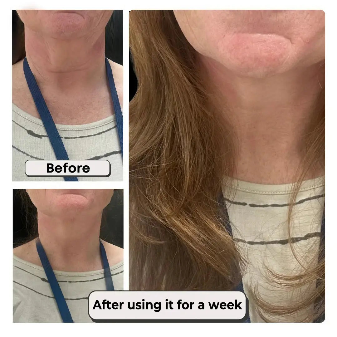 Tautelle™ – Invisible Lifting Tape for Neck Wrinkles &amp; Sagging Skin + 1+1 FREE