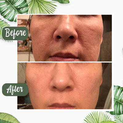 GreenCleanse Stick – Effortlessly Purify Your Skin & Reveal Your Natural Radiance - 50% OFF